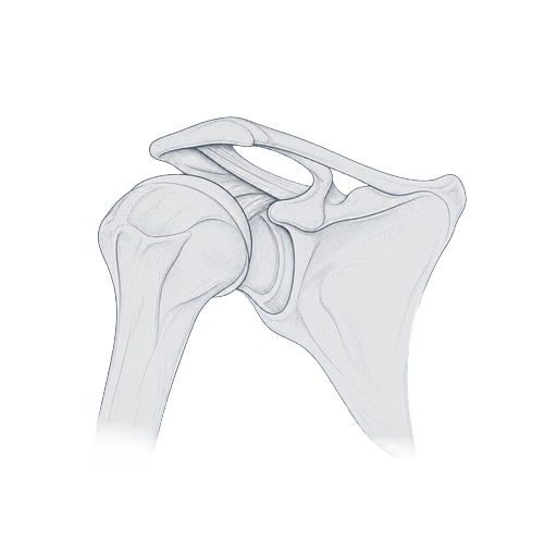 Complex primary arthroplasty illustration